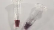 Nanopartículas de oro Nanopartículas de oro